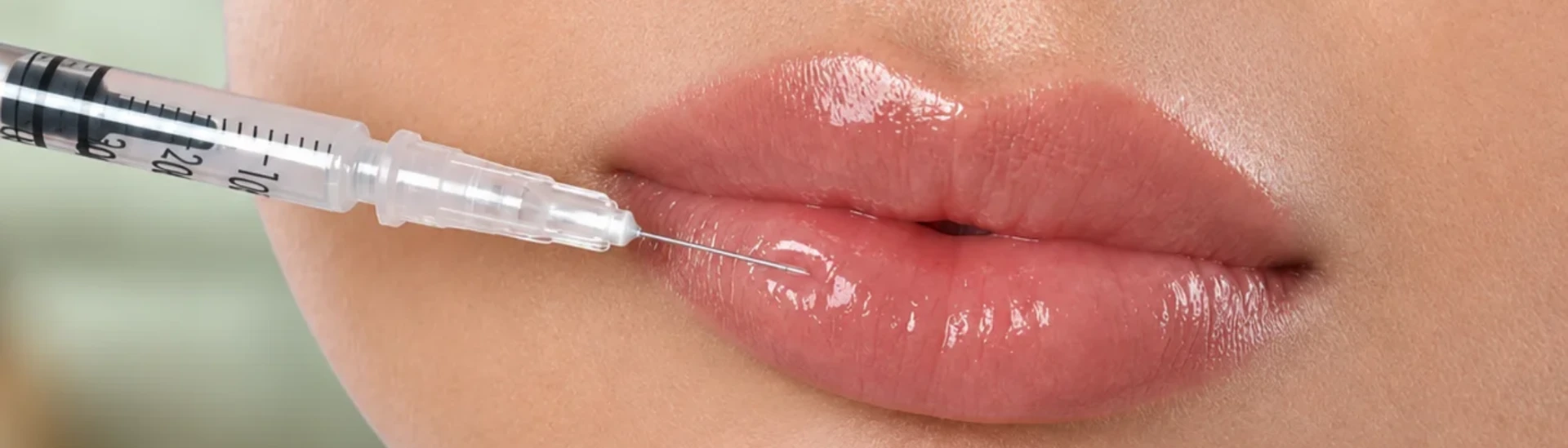 Close-up of a natural lip filler treatment with a fine needle at Tula Tu Aesthetics in The Woodlands, TX